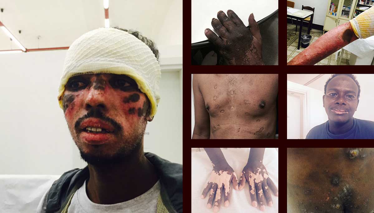 http://projects.voanews.com/adrift-african-diaspora/tigrigna/img/21-gallery-libya-migrant-mutilation_thumb_1200.jpg
